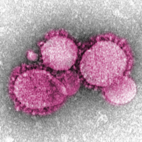 coronavirus